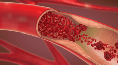 Nº 1 CBD: el efecto en las arterias