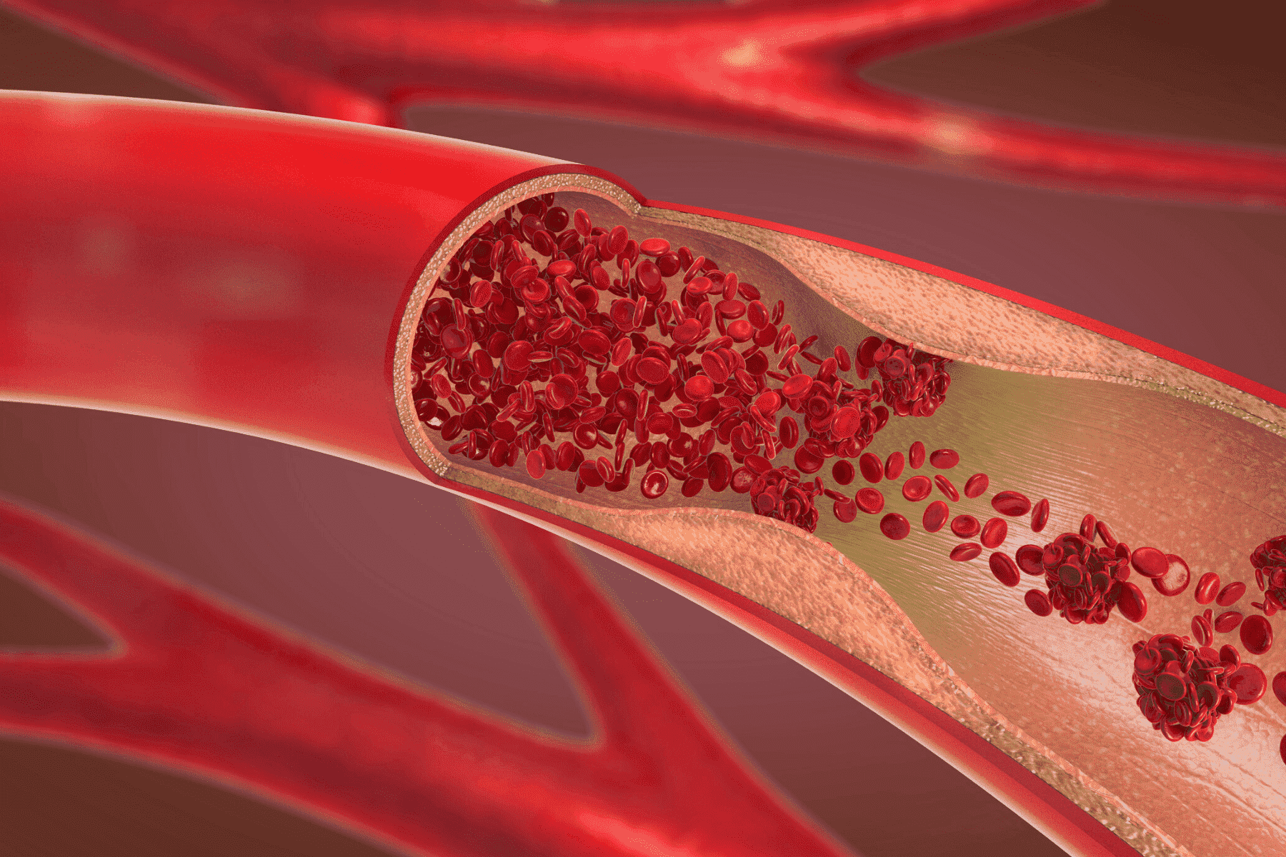 Nº 1 CBD: el efecto en las arterias