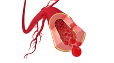 Nº 3 CBD: el efecto en las arterias