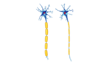 Nº1 CBD y la Esclerosis Múltiple